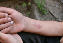 UN chief calls for people-centered approach to combat drug stigma