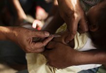 Western Pacific countries at risk of measles outbreaks due to immunisation and surveillance gaps
