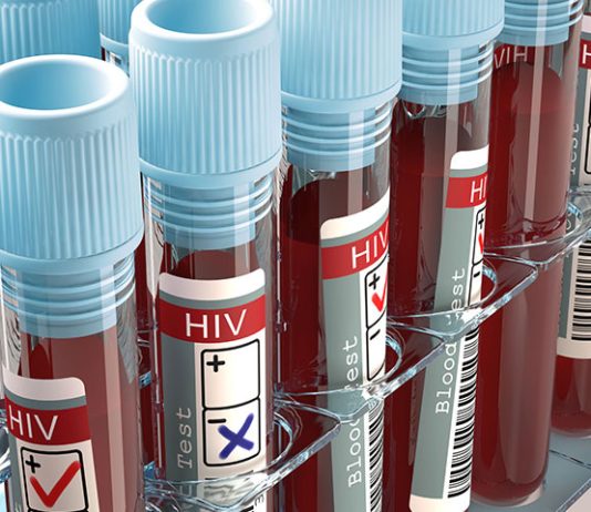 HIV epidemic worsening as Fiji records 2,003 new cases in 2025: Health Minister Lalabalavu