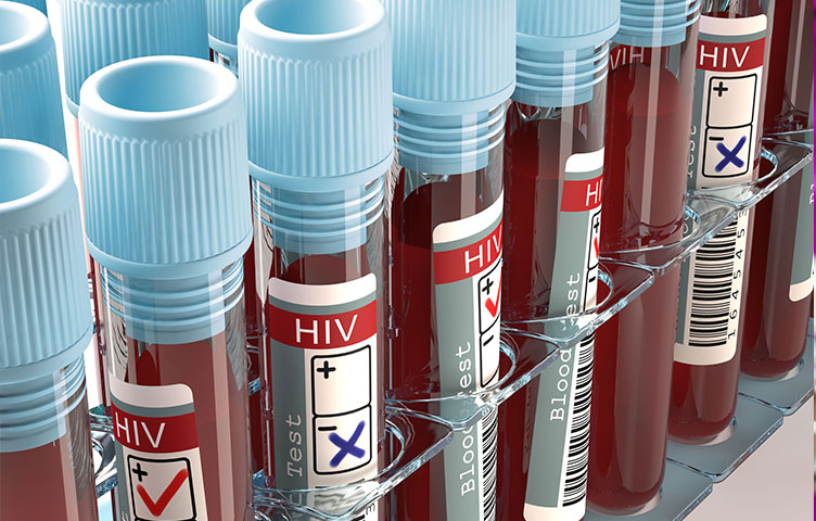 HIV epidemic worsening as Fiji records 2,003 new cases in 2025: Health Minister Lalabalavu
