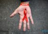 WHO and UNAIDS warn HIV gains at risk as funding cuts threaten AIDS response