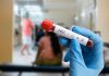 Two HIV cases confirmed in Niue, public health risk assessed as low
